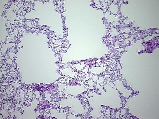 4x Image