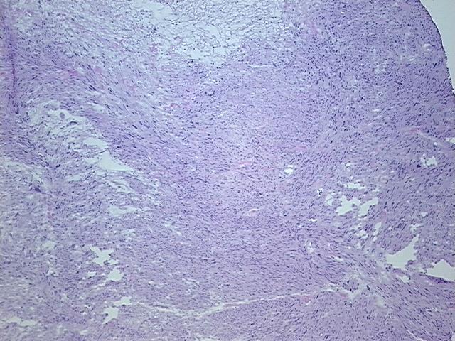 4x Image