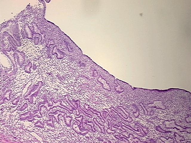 4x Image