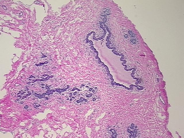 4x Image