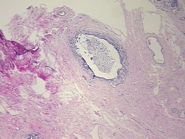 4x Image