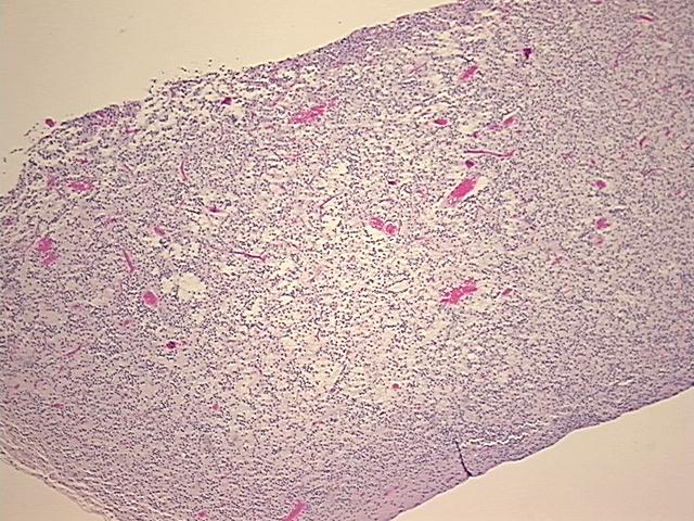 Tissue FFPE Sections, Brain | OriGene Technologies Inc.