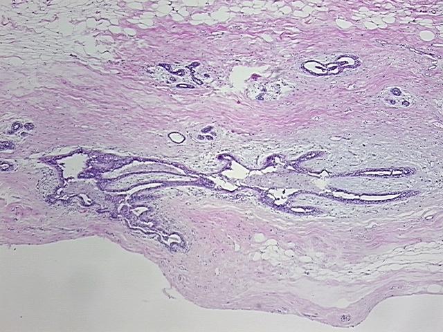 4x Image
