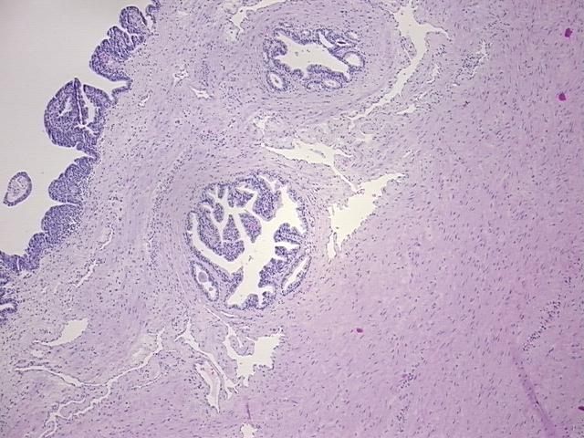 4x Image