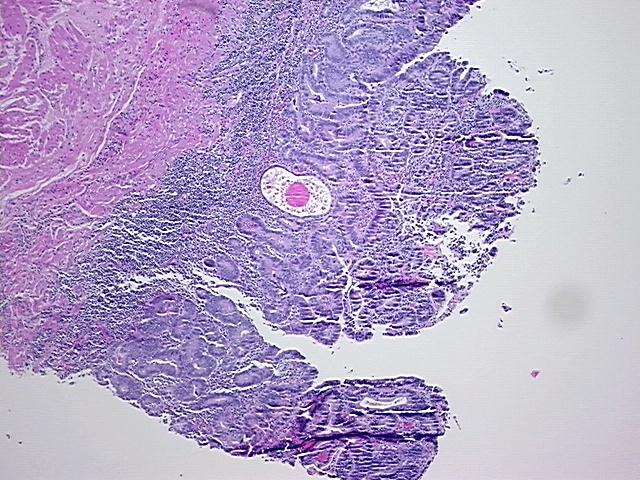 4x Image