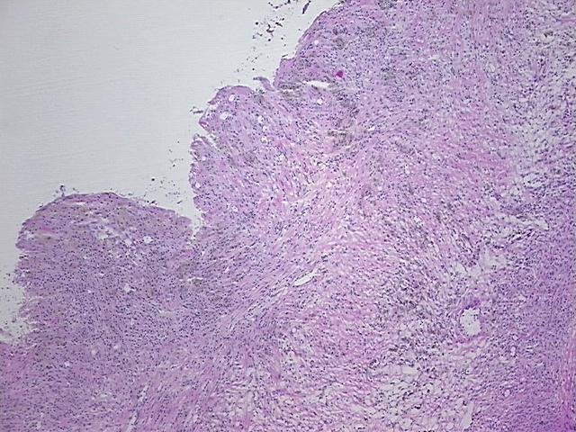 4x Image