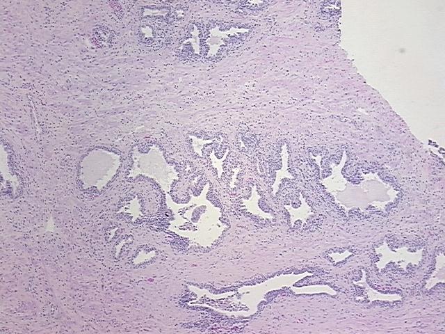 4x Image