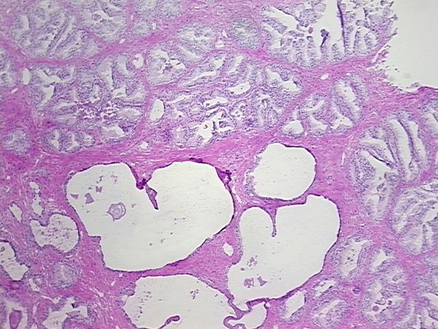 4x Image