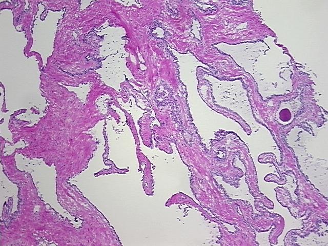4x Image