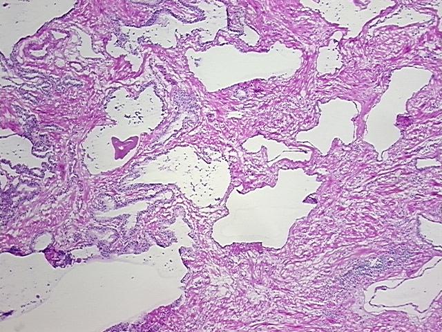 4x Image