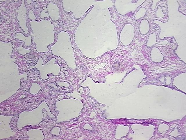 4x Image