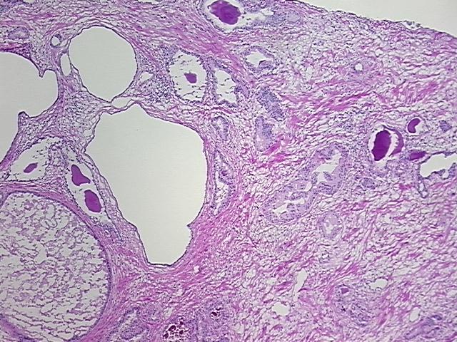 4x Image