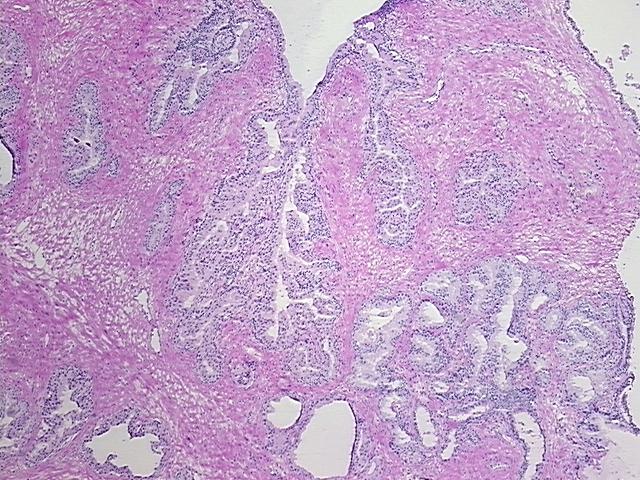 4x Image