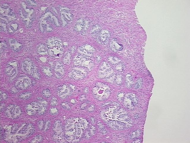 4x Image