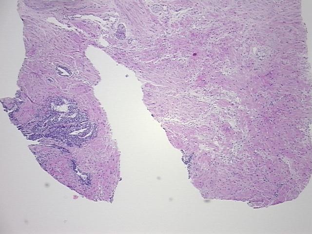 4x Image