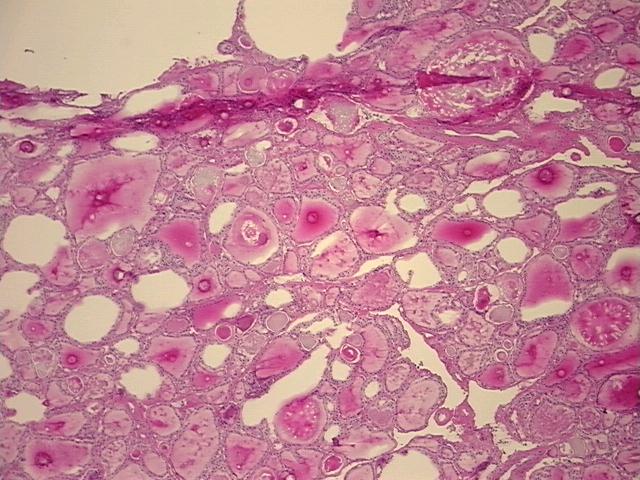 4x Image
