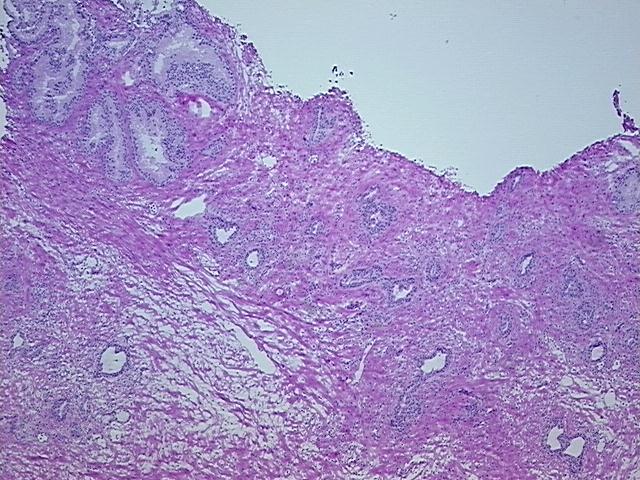 4x Image