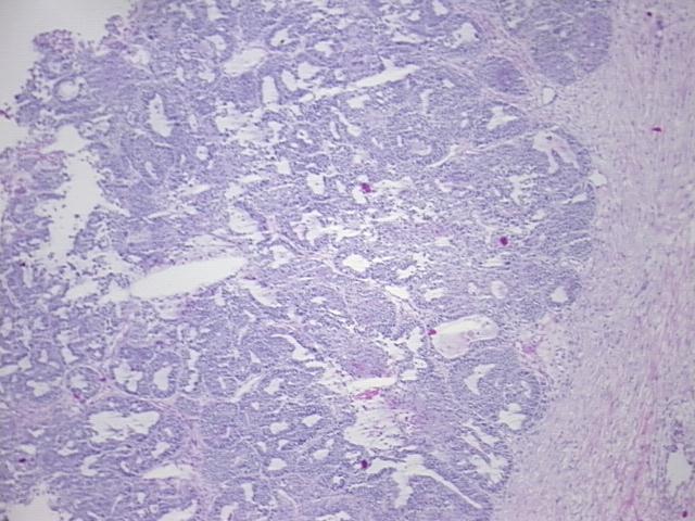 4x Image