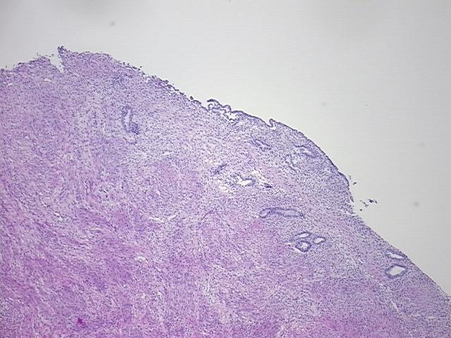 4x Image