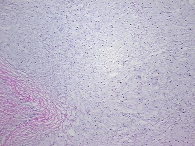 4x Image