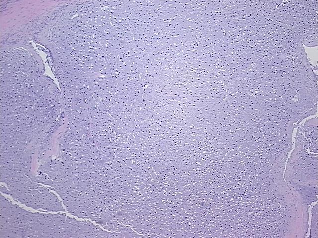 4x Image