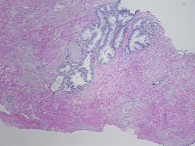 4x Image