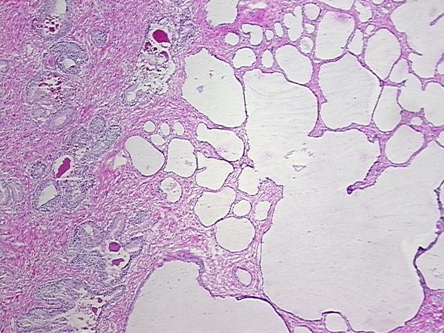 4x Image