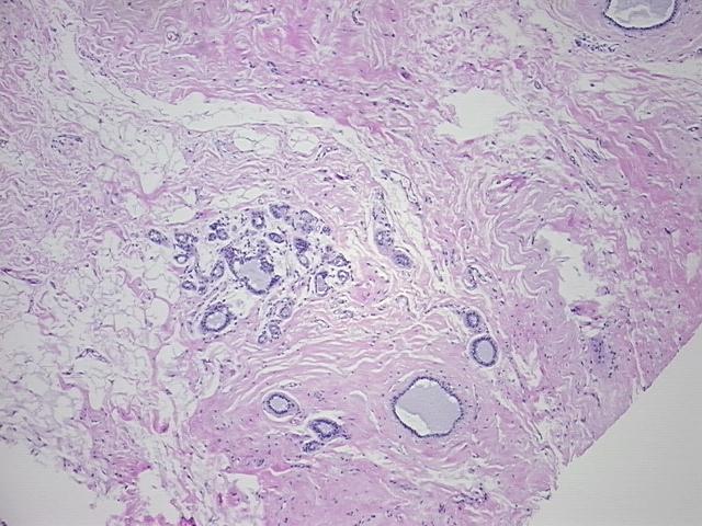 4x Image