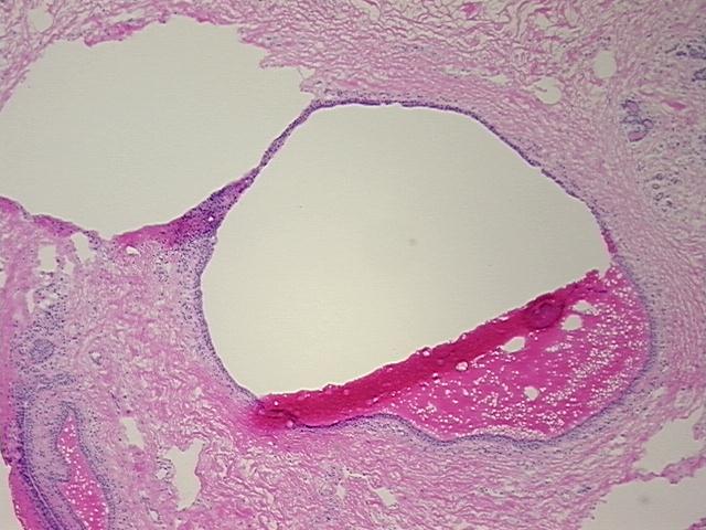 4x Image