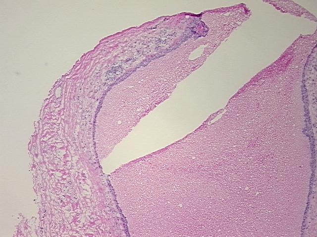 4x Image