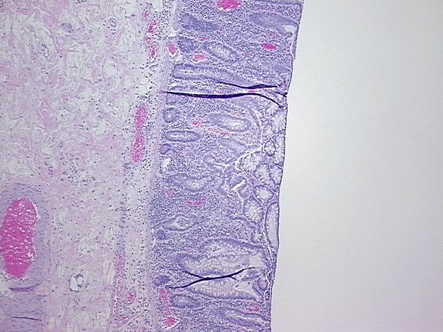 4x Image
