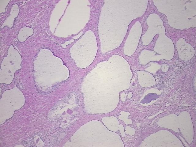 4x Image