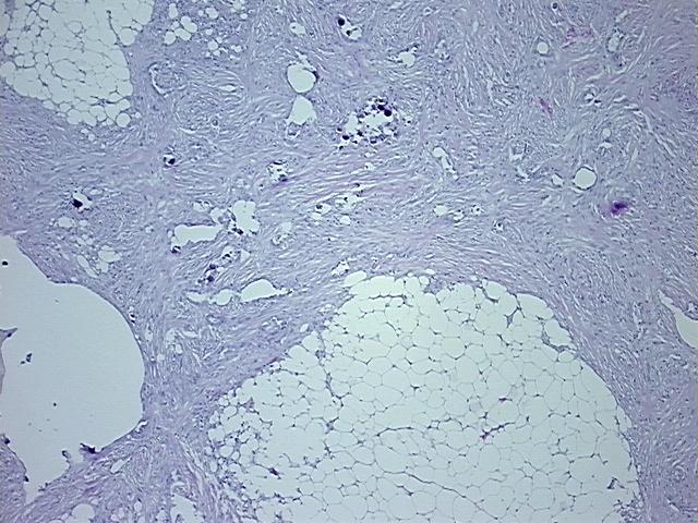 4x Image