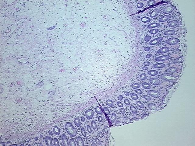 4x Image