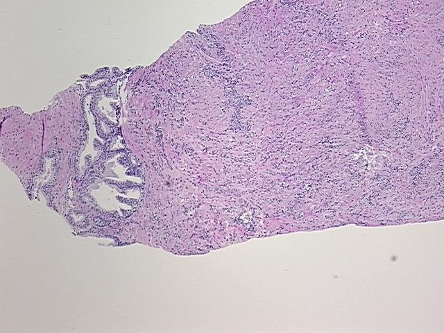 4x Image