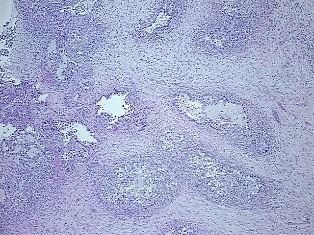 4x Image