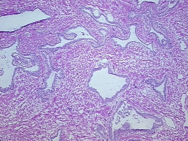 Frozen Tissue Sections, Prostate