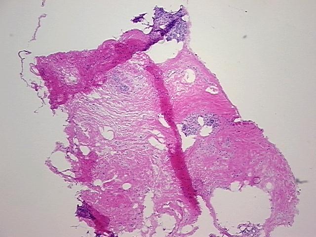 4x Image