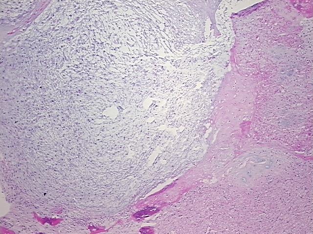 4x Image