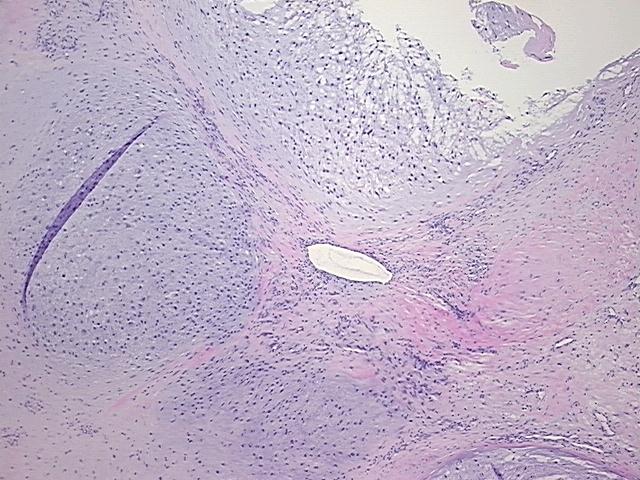4x Image