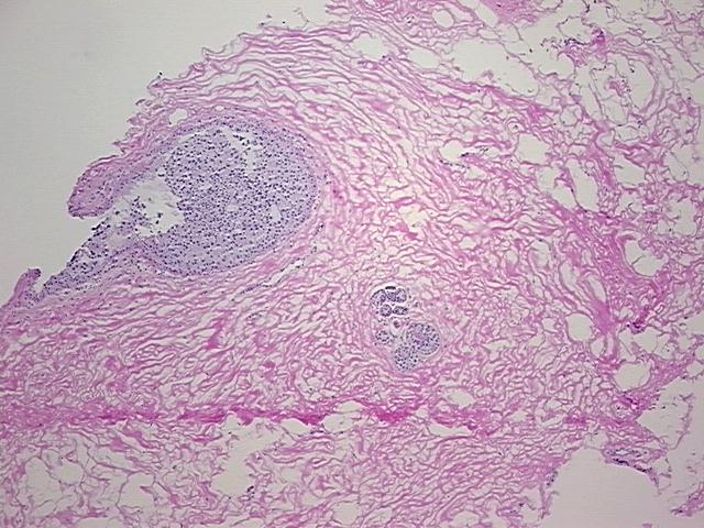 4x Image