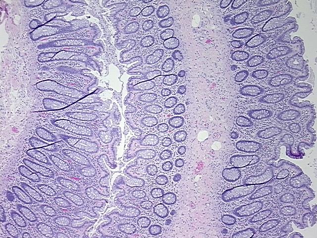 4x Image