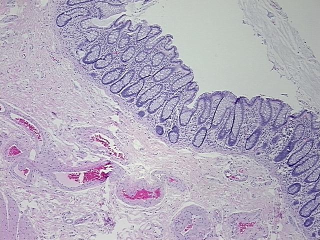 4x Image