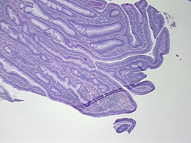 4x Image