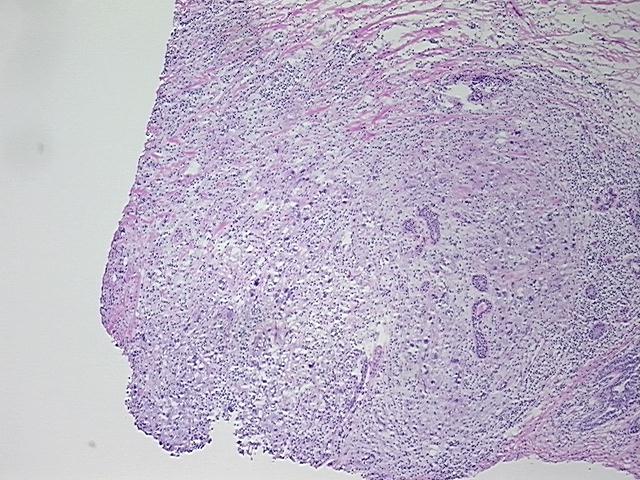 4x Image