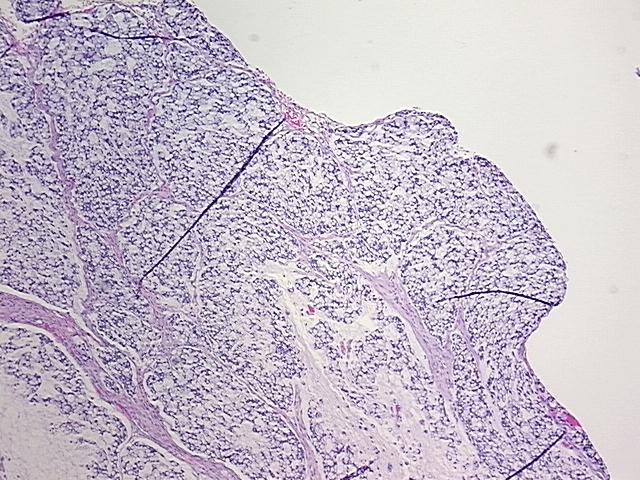 4x Image
