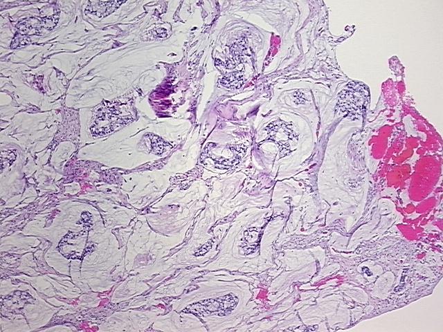 4x Image