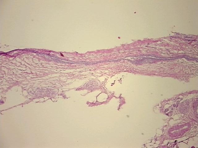 4x Image