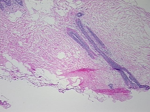 4x Image