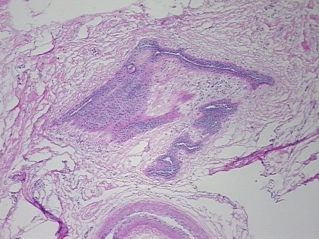4x Image